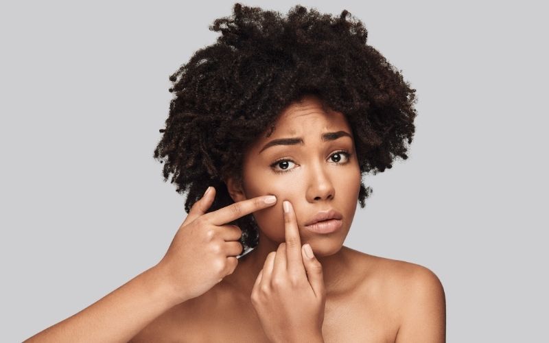Cómo influye la dieta en el acné